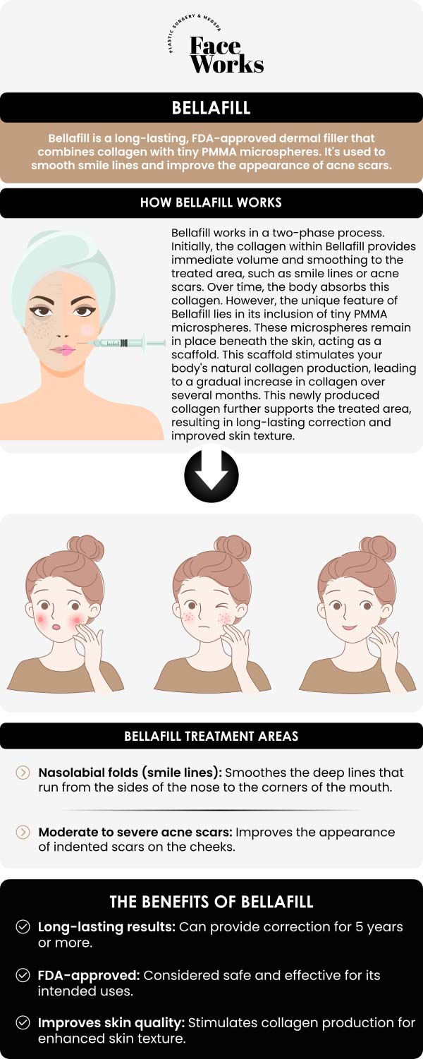 Common questions asked by patinets: What is Bellafill, and what makes it different from other dermal fillers? Why is Bellafill considered a semi-permanent or long-term filler, unlike hyaluronic acid-based fillers? How does the injection process stimulate your body's own natural collagen production? What specific aesthetic concerns can Bellafill effectively treat?For more information, contact us or request an appointment online. We serve patients from Schaumburg IL, Hoffman Estates IL, Rolling Meadows IL, Hanover Park IL, Streamwood IL, Elk Grove Village IL, and surrounding areas.