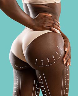 Brazilian Butt Lift in Schaumburg, IL and Chicago, IL Brazilian Butt Lift in Schaumburg, IL and Chicago, IL