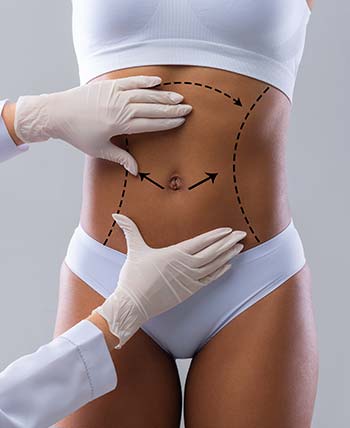 Cellulite Treatment by Aveli in Schaumburg, IL and Chicago, IL Cellulite Treatment by Aveli in Schaumburg, IL and Chicago, IL