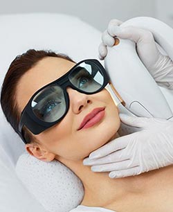 Dermaplaning in Schaumburg, IL and Chicago, IL Dermaplaning in Schaumburg, IL and Chicago, IL