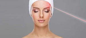 Laser Pigmentation Lesions Specialist in Schaumburg, IL