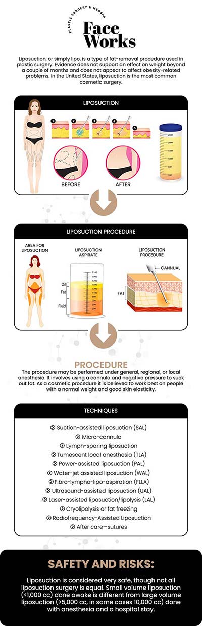 At Face Works Plastic Surgery, we offer Hi-Def Vaser Liposuction, a state-of-the-art procedure designed for advanced body sculpting. Under the care of Dr. Paul C. Dillon, a board-certified plastic surgeon, this technique precisely removes unwanted fat while sculpting and defining underlying muscles. The result is a more athletic and toned physique, providing a truly high definition appearance. For more information, contact us or request an appointment online. We are conveniently located at 501 W Golf Rd A, Schaumburg, IL 60195