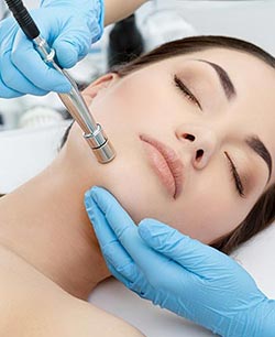 Microdermabrasion in Schaumburg, IL and Chicago, IL Microdermabrasion in Schaumburg, IL and Chicago, IL