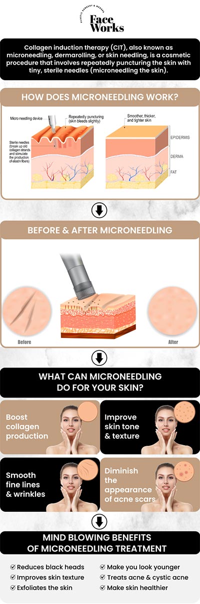 At Face Works Plastic Surgery, we specialize in advanced microneedling combined with exosome therapy—a powerful, regenerative skin treatment designed to stimulate collagen, improve texture, and restore your natural glow. Led by Dr. Paul C. Dillon, M.D., our clinic offers personalized care using the latest techniques in skin rejuvenation. Exosomes enhance the results of microneedling by delivering growth factors that accelerate healing and boost skin regeneration. For more information, contact us or request an appointment online. We are conveniently located at 501 W Golf Rd A, Schaumburg, IL 60195.