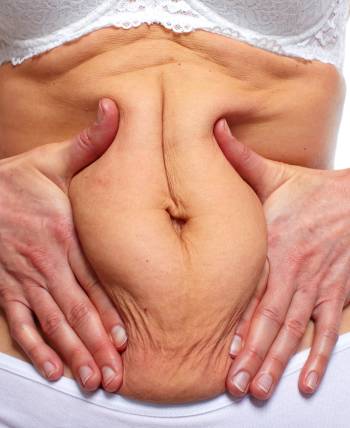 Non-Surgical in Schaumburg, IL and Chicago, IL Non-Surgical in Schaumburg, IL and Chicago, IL