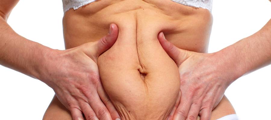 Non-Surgical Body Contouring & Sculpting Specialist in Schaumburg, IL