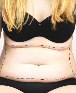 Surgical Under Anesthesia in Schaumburg, IL and Chicago, IL Surgical Under Anesthesia in Schaumburg, IL and Chicago, IL