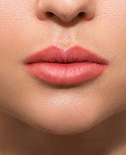 Temporary Fillers Full Syringe in Schaumburg, IL and Chicago, IL Temporary Fillers Full Syringe in Schaumburg, IL and Chicago, IL