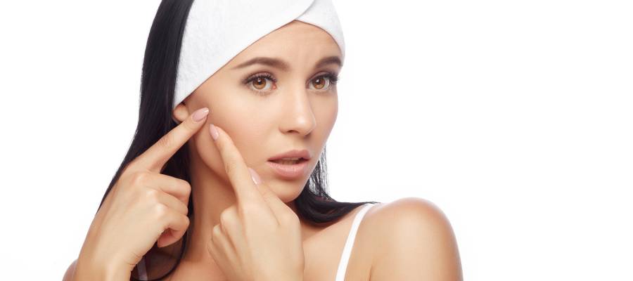 Acne Scar Treatment in Schaumburg, IL