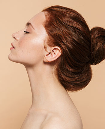Jawline with Fillers in Schaumburg, IL and Chicago, IL Jawline with Fillers in Schaumburg, IL and Chicago, IL