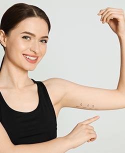 HD Arm Lipo 360 in Schaumburg, IL and Chicago, IL HD Arm Lipo 360 in Schaumburg, IL and Chicago, IL