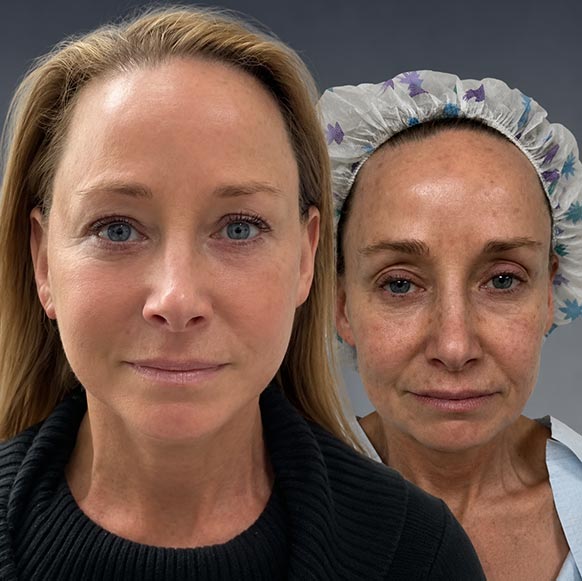 AwakeTight™ at Face Works Plastic Surgery, Plastic Surgeon Near Me in Schaumburg, AwakeTight™ at Face Works Plastic Surgery, Plastic Surgeon Near Me in Schaumburg,