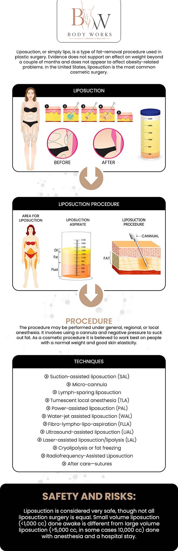 Common questions asked by patients: What is Awake High-Def Chin Lipo? What are the benefits of staying awake during chin liposuction? Will chin lipo help with loose skin or a "turkey neck"? Are the results of chin lipo permanent? For more information, contact us or request an appointment online. We are conveniently located at 3918 W 63rd St Chicago, IL 60629