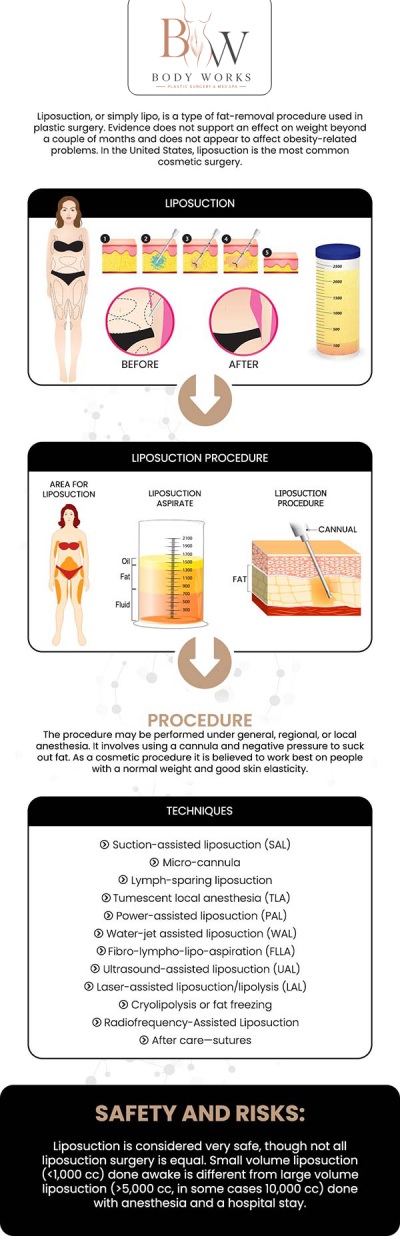 Common questions asked by patients: What is Awake High-Def Chin Lipo? What are the benefits of staying awake during chin liposuction? Will chin lipo help with loose skin or a "turkey neck"? Are the results of chin lipo permanent? For more information, contact us or request an appointment online. We are conveniently located at 3918 W 63rd St Chicago, IL 60629